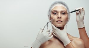 Woman being prepared for facelift surgery.