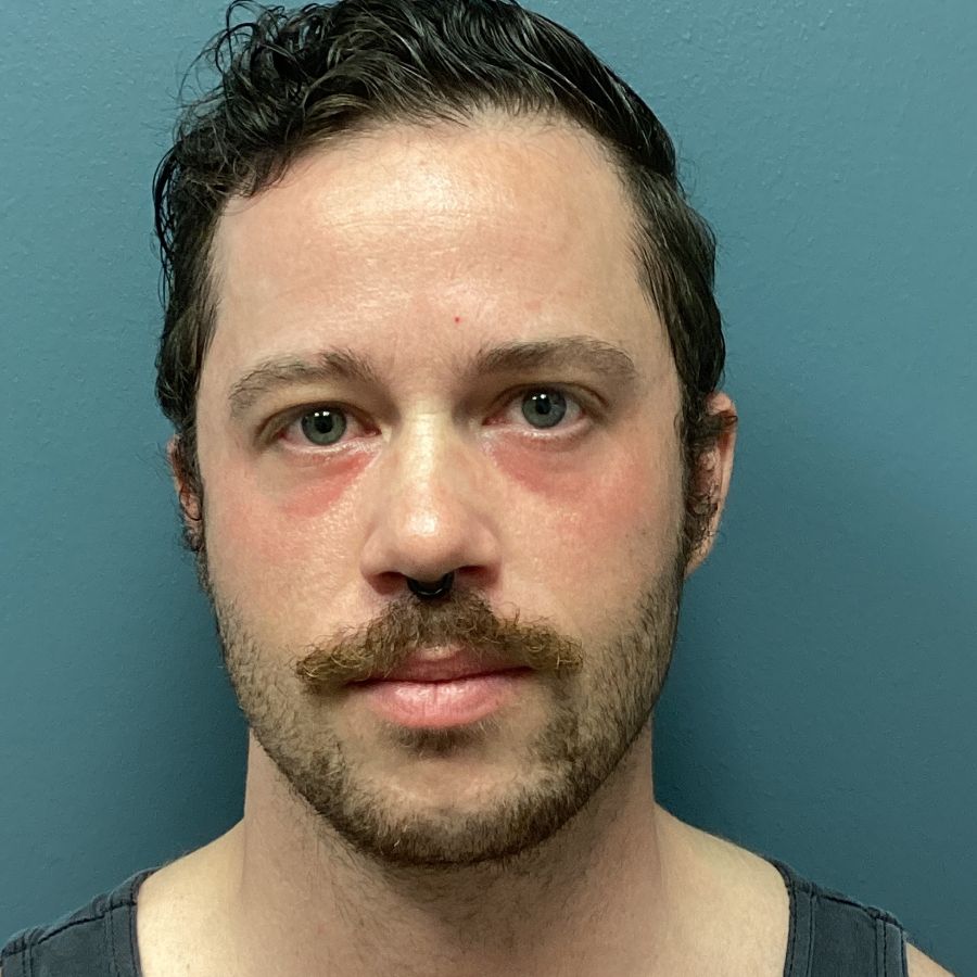 After blepharoplasty procedure